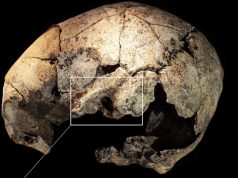 En la Prehistoria hacían trepanaciones: aparecen evidencias de una cirugía cerebral de hace 10.000 años