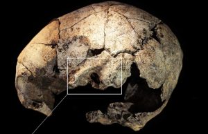 En la Prehistoria hacían trepanaciones: aparecen evidencias de una cirugía cerebral de hace 10.000 años